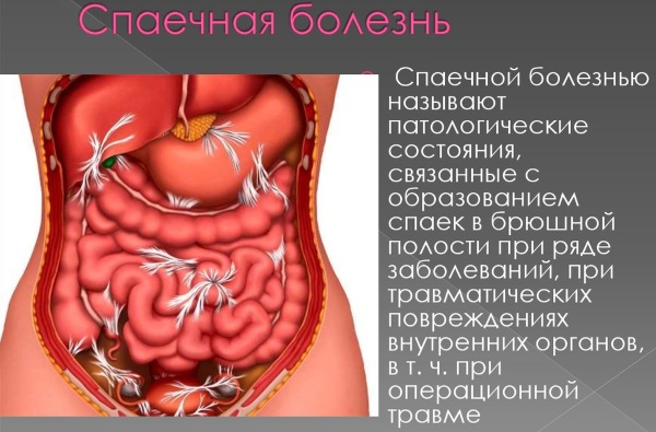 Тянущая боль внизу живота у женщин. Причины перед месячными, во время беременности