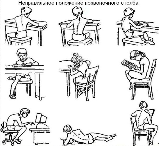 Упражнения от сколиоза для детей, 1-2 степени, по Бубновскому. Методики, как выполнять в домашних условиях