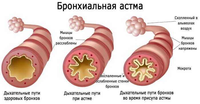 Амосин. Инструкция по применению, цена, аналоги, отзывы