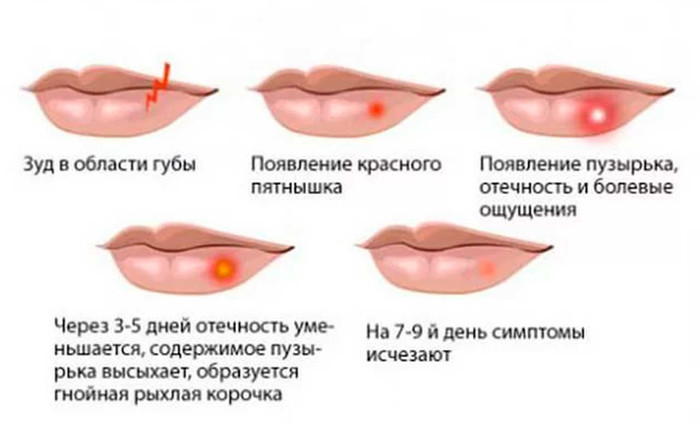 Ацикловир мазь. Инструкция по применению, цена, аналоги, отзывы