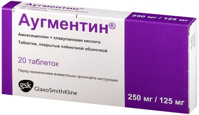 Боль в правом боку на уровне талии со спины, спереди, сбоку. Что это может быть, что делать