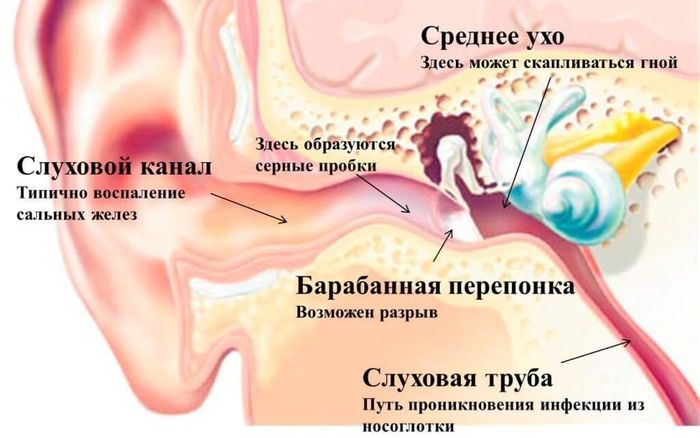 Болезни уха у взрослых. Симптомы и лечение народными средствами, капли, процедуры