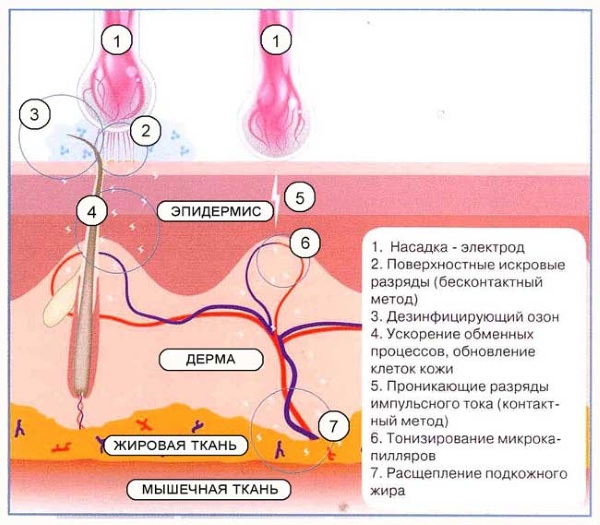 Болит сосочек левый/правый у женщин, девушек-подростков. Почему при нажатии, прикосновении, что делать