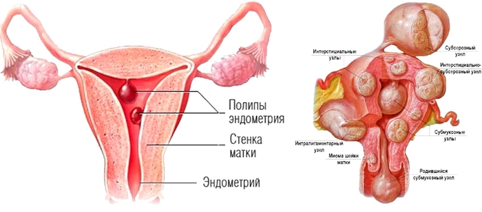 Дубовая кора. Лечебные свойства, рецепты применения для мужчин, женщин. Противопоказания