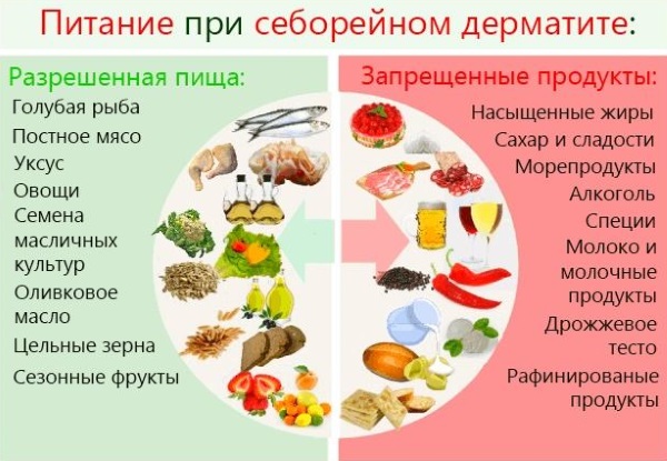 Как избавиться от себореи на голове у взрослых, ребёнка, грудничка