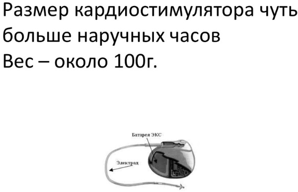 Почему в инструкции людям с кардиостимуляторами запрещается. Кардиостимулятор Размеры. Установка кардиостимулятора. Установка однокамерного кардиостимулятора.