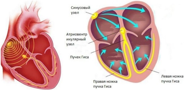 Кардиостимулятор. Что это такое, виды, как работает, сколько стоит, операция по установке, жизнь с ним