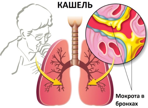 Коделак Нео. Инструкция по применению сироп, таблетки, капли. Цена, аналоги