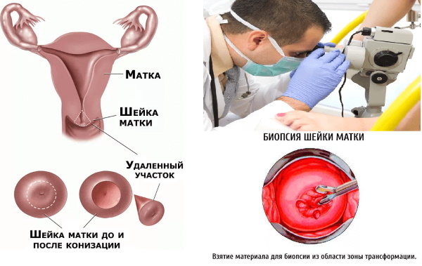 Коричневые выделения перед месячными. Что это значит, возможна ли беременность, что делать