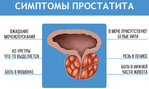 Как быстро вылечить простатит в домашних условиях. Антибиотики, народные средства, процедуры