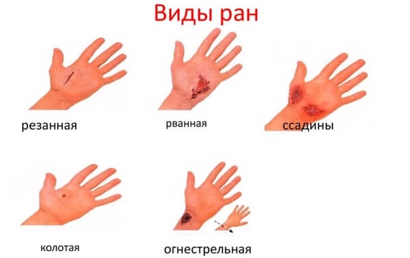 Мази для заживления ран и ссадин для детей на лице, с антибиотиком. Цены, отзывы