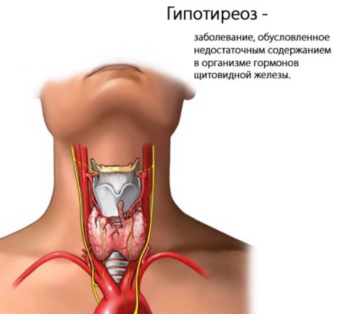 Почему мерзнут руки и ноги у женщин и мужчин. Причины и лечение