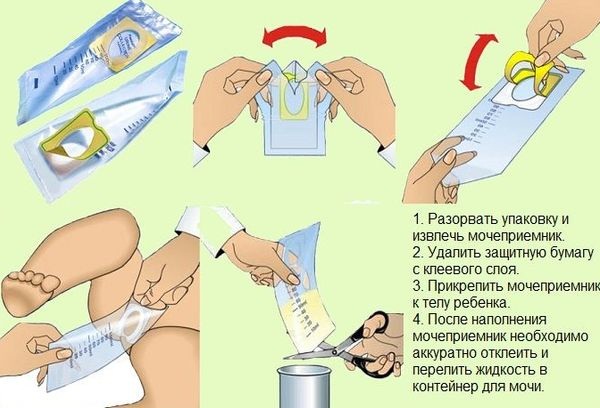 Моча по Нечипоренко. Норма у взрослых, детей лейкоцитов/эритроцитов, как сдавать, расшифровка