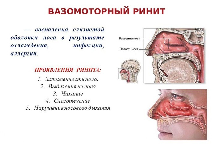 Оксолиновая мазь. Инструкция по применению, цена, аналоги, отзывы