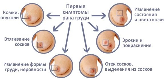 Определение болезни по симптомам самостоятельно. Тесты, таблица признаков