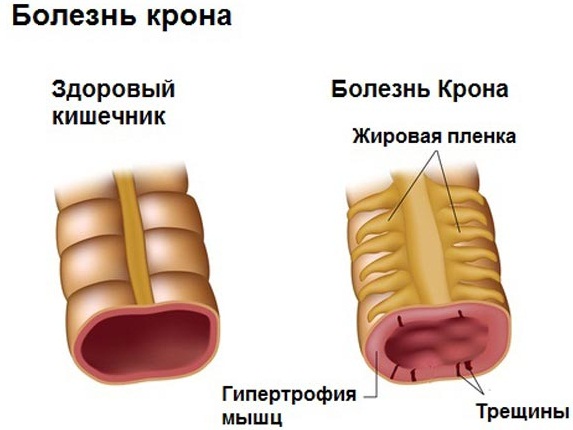 Определение болезни по симптомам самостоятельно. Тесты, таблица признаков