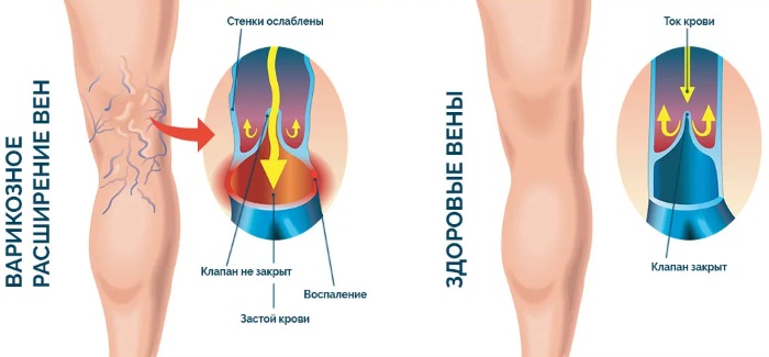 Определение болезни по симптомам самостоятельно. Тесты, таблица признаков