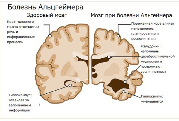 Определение болезни по симптомам самостоятельно. Тесты, таблица признаков