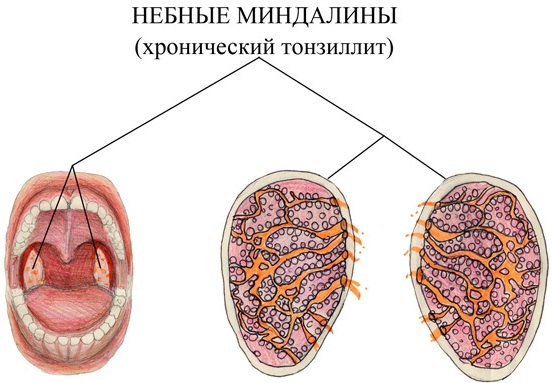 Определение болезни по симптомам самостоятельно. Тесты, таблица признаков