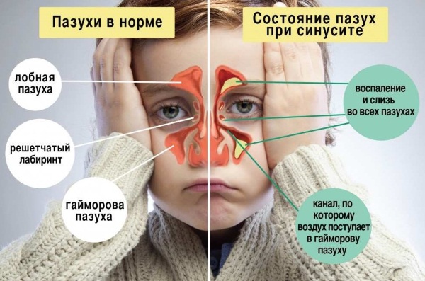 Определение болезни по симптомам самостоятельно. Тесты, таблица признаков