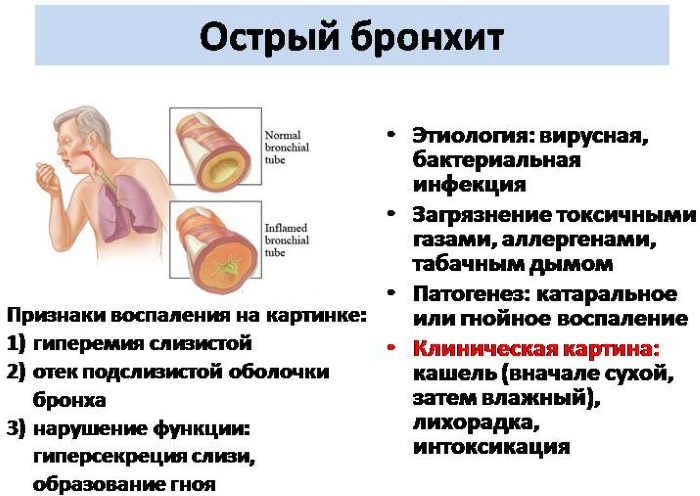 Острый бронхит. Симптомы и лечение, антибиотики, народные средства, таблетки