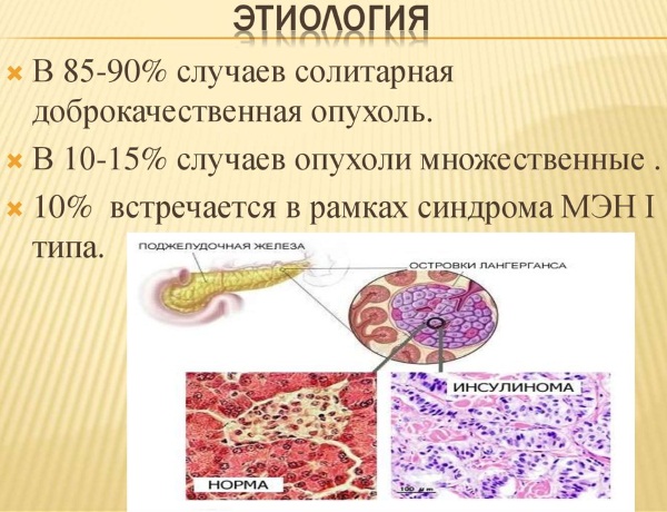 Повышенный инсулин в крови: что это значит, симптомы, причины