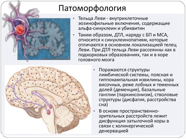 Старческое слабоумие. Симптомы и признаки у женщин, лечение деменции, препараты, уход