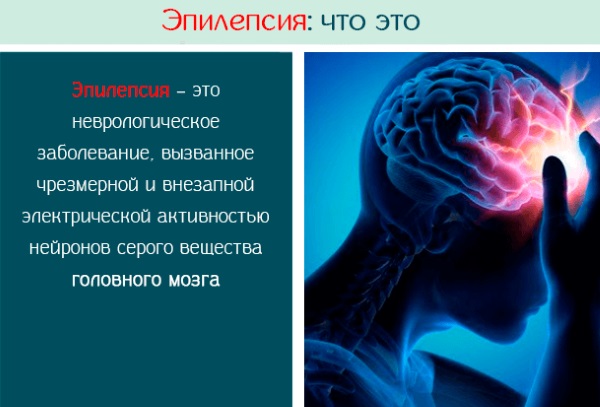 Сводит мышцы по всему телу. Причины и лечение, чего не хватает в организме