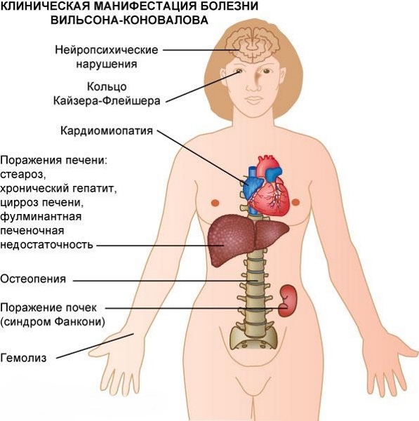 Тремор рук. Причины и лечение в молодом возрасте, у взрослых, пожилых