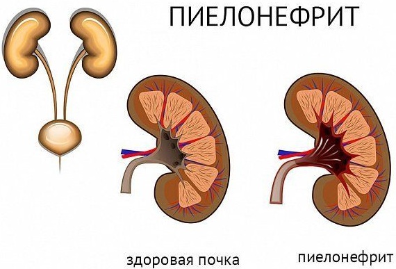 Тянет низ живота. Причины у женщин после овуляции, месячных, при климаксе