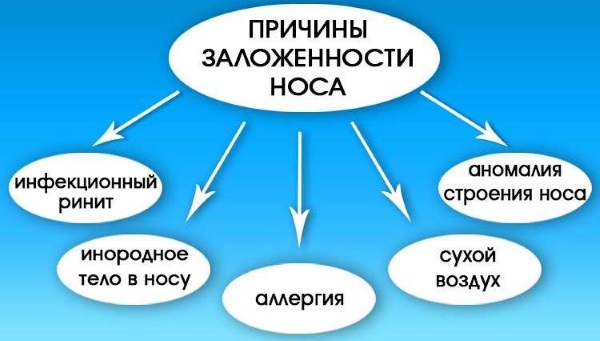 Заложенность носа без насморка. Причины и лечение, народные средства, капли