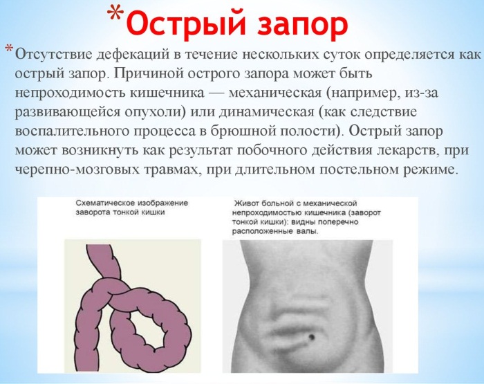 Запоры у взрослых. Причины и лечение, как избавиться народными средствами, лекарства, питание