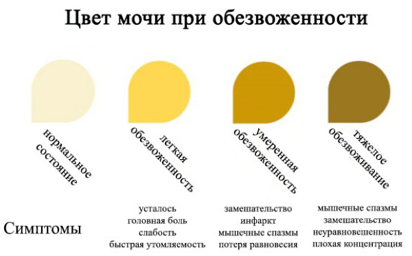 Желтая моча. Причины у женщин ярко-, темно-желтая при беременности, с запахом, белыми хлопьями. Что это может быть