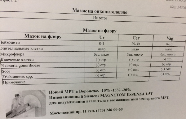 Анализ на микрофлору в гинекологии. Сколько делается, норма, расшифровка