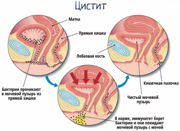 Анализ на микрофлору в гинекологии. Сколько делается, норма, расшифровка