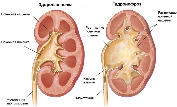 Тянущая боль в правом подреберье спереди. Причины, лечение