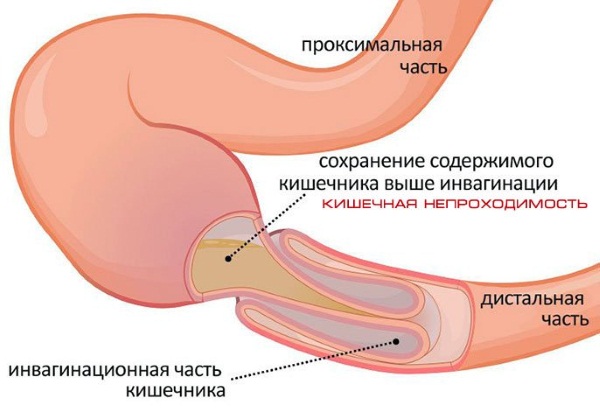 Гематокрит повышен у взрослого в крови. Причины у мужчины, женщины