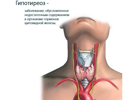 Гипотиреоз. Симптомы у женщин в менопаузе, при беременности. Лечение, последствия, рекомендации