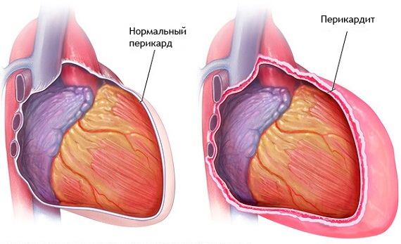 Гликозиды сердечные препараты. Весь перечень, классификация, названия, цены