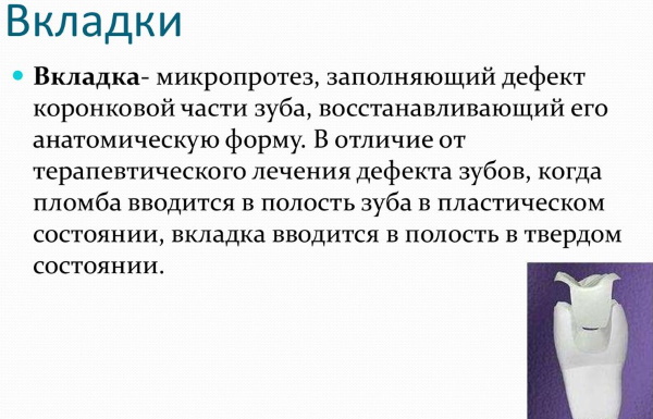 Керамические вкладки на зубы. Что это такое, фото, цена, отзывы врачей