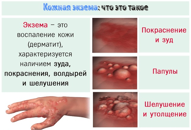 Комфодерм крем. Инструкция по применению, цена, аналоги, отзывы