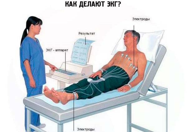 Легочная артерия. Где находится, норма давления, симптомы и лечение тромбоза, стеноза, гипертензия. Клинические рекомендации