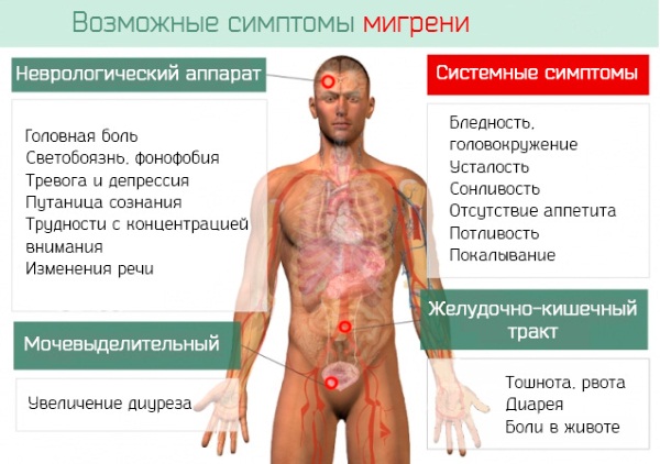 Мигрень. Симптомы и лечение у женщин таблетками, народные средства, сколько дней болит голова