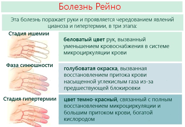 Почему немеет рука левая/правая, кисть, кончики пальцев, от локтя по ночам во сне. Что делать, лечение