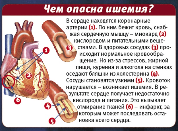 Пароксизмальная тахикардия карта смп