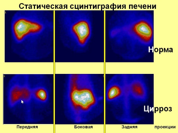 Печень у человека. Где находится, функции, анатомия, симптомы заболеваний, лечение