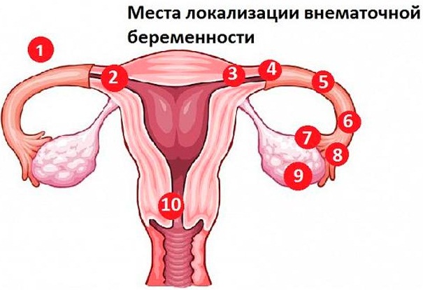 Почему не идут месячные. Причины, кроме беременности, что делать