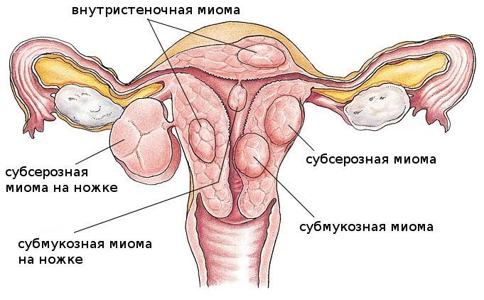 Почему не идут месячные. Причины, кроме беременности, что делать