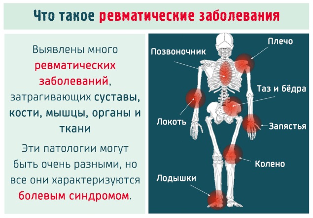 Хронический фарингит. Симптомы и лечение у взрослых, препараты, народные средства