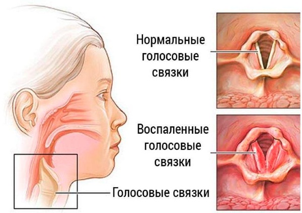 Сапрофитическая микробиота СМБ (микрофлора). Что это такое, что значит